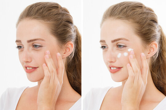 Before-after moisturizing cream. Closeup problem skin portrait Beautiful caucasian woman. Dark circles under eyes, eye bags. Anti aging wrinkles. Skin-care female face. Before after skincare routine