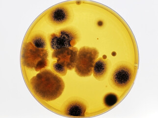 Microbiology. Petri dish with a culture of different fungi isolated from the soil. Infectious...