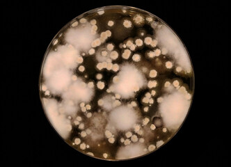 Microbiology. Petri dish with a culture of different fungi isolated from the soil. Infectious...