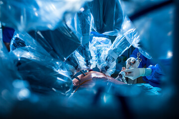 Fototapeta na wymiar Surgery in a modern hospital being performed by a team of professionals (shallow DOF, color toned image)