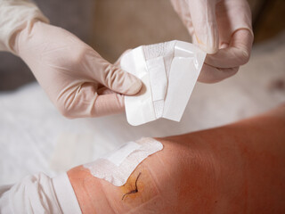 Close-up of the replacement of a sterile patch by a nurse with a glove on a patient's knee after surgery