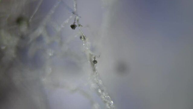 Fungus under a microscope. Mold structure. The study of microorganisms. Science and laboratory research