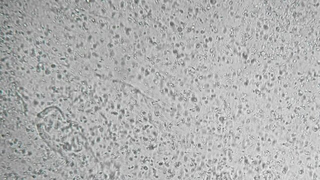 Genetic sample. Reproductive function of man. Slow motion filming of the movement of active spermatozoa under a microscope. Sperm bank. The survival of all mankind. Macro