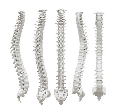 Broken backbone, illustration - Stock Image - C036/3987 - Science Photo  Library