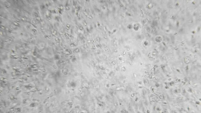 Slow motion filming of the movement of active spermatozoa under a microscope. Sperm bank. reproductive function of man. The survival of all mankind