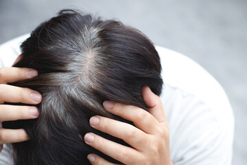 Fototapeta premium Back view of young people premature gray hair, showing black hoary hair roots on head change to senior old man outdoor.