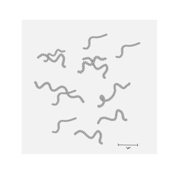 The picture of Marburg Virus in Filoviridae family that investigates under Electron Microscope (EM).