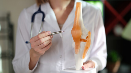 Rheumatologist points to anatomical model of human knee joint.