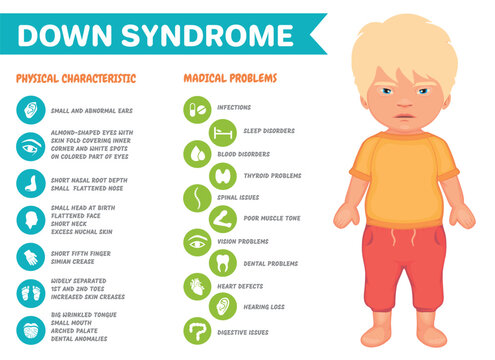 Symptoms of down syndrome vector infographic poster