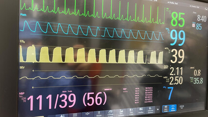 Hospital monitor in healthcare showing electrocardiogram and anesthesiology machine showing heart...