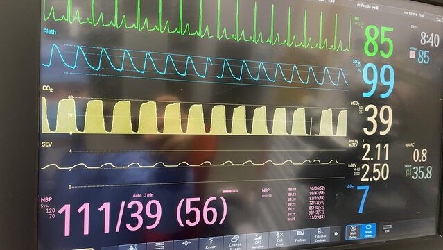 Hospital monitor in healthcare showing electrocardiogram and anesthesiology machine showing heart beat and life of patient with normal blood pressure showing new technology