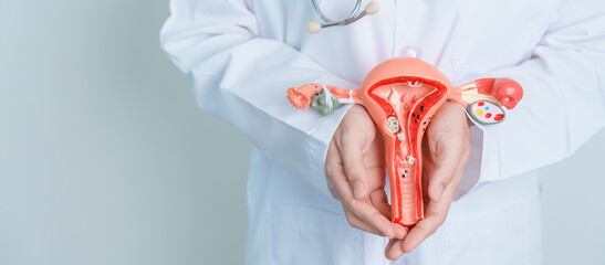 Doctor holding Uterus and Ovaries model. Ovarian and Cervical cancer, Cervix disorder,...