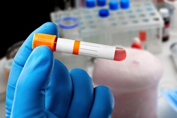 Doctor holding test tube with blood