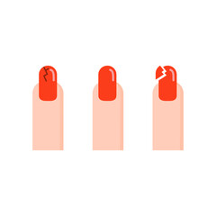 Set of Broken Red Nail Polish Fingernail. Beauty, Self care, healthcare concept. Flat cartoon vector design illustration
