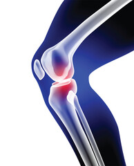 3D illustration of thigh and calf muscles connected to knee bone on dark blue background. It is used in medicine, sports and education. - obrazy, fototapety, plakaty