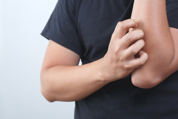 Health problems, man has itchy hands