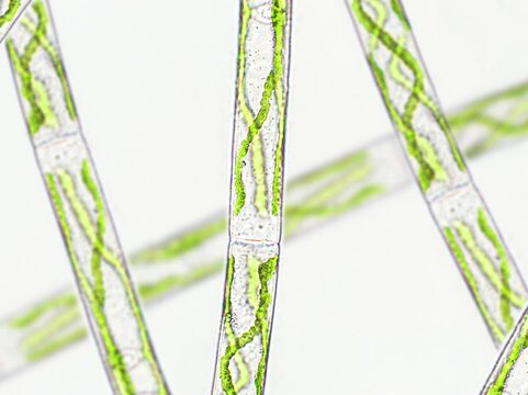 Spirogyra sp. green algae under microscopic view - Chlorophyta