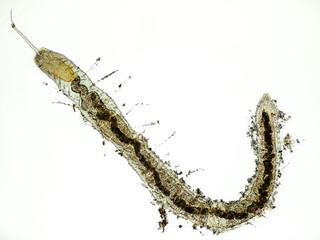 Stylaria lacustris (worm of the family Naididae) under the microscope - light microscope x32 magnification