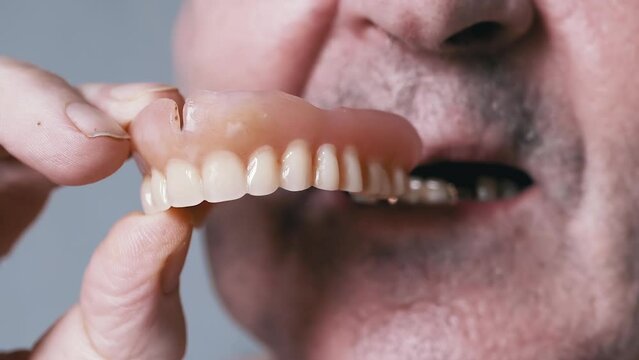 Close up, Smiling Elderly Male Pensioner with False Dentures and Golden Teeth. Old pensioner holds in hands removable dentures of upper jaw. Laughing wrinkled, unshaven face of a senior. Open mouth.