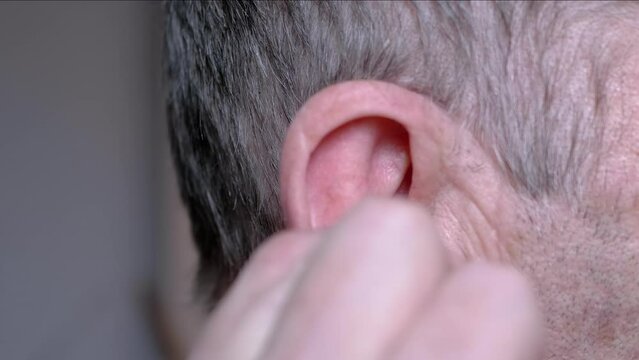 Close up, an Elderly Man Cleaning the Ear Canal with a Cotton Swab from Earwax. Ears are dirty. Old pensioner, a grandfather, cleans his ear with a swab. Blockage of the ear canal. Hearing loss. Help.
