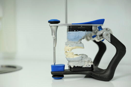 An articulator used in dental laboratories clipped on white background dental articulator with dental gypsum prosthesis model in dental laboratory. High quality photo Vinnytsia Ukraine 2023