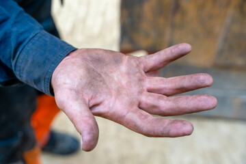 Working man with tired cracked dirty hands. Worker with empty hands