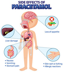 Human anatomy diagram cartoon style of paracetamol side effects - obrazy, fototapety, plakaty