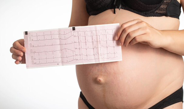 A pregnant girl holds a cardiogram against the background of her stomach. The concept of cardiac abnormalities in girls during pregnancy. Tachycardia and heart block, coronary heart disease