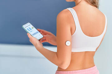 Diabetic patient using sensor and phone for remote glucose monitoring, sugar diabetes treatment - obrazy, fototapety, plakaty