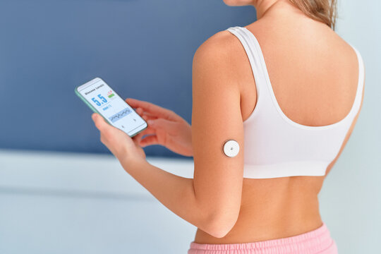 Diabetic patient using sensor and phone for remote glucose monitoring, sugar diabetes treatment