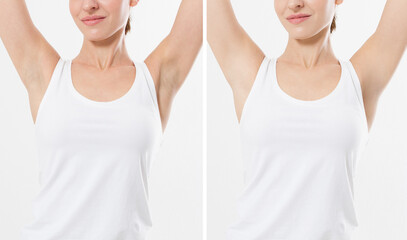 Blank template t shirt. Before after Beauty Woman perfect skin armpits epilation isolated....