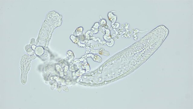 Part of Siphonophora colony under a microscope, class Hydrozoa. Trapping tentacles, gonozoid or gastrozoid are visible. Sample found in Red Sea