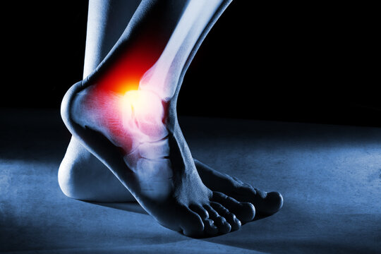 Human foot ankle and leg in x-ray on blue background. The foot ankle is highlighted by red-yellow colour.