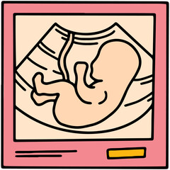 Ultrasound image with an embryo baby, pregnancy scan