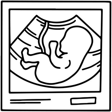 Ultrasound image with an embryo baby icon, pregnancy scan