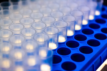 Pipette tips in laboratory