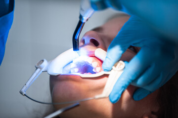 The dentist uses an ultraviolet lamp while fitting the girl with braces