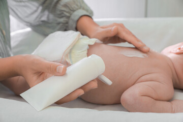 Mother applying moisturizing cream onto baby`s back on changing table, closeup
