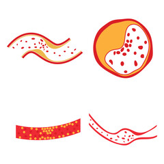 vector of cholesterol plaque
