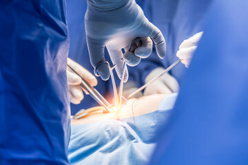Surgeon or doctor in blue uniform did surgery in surgical hospital with orange light effect and blur background. Surgeon and nurse use medical instrument or equipment in operating room.People working. - Powered by Adobe