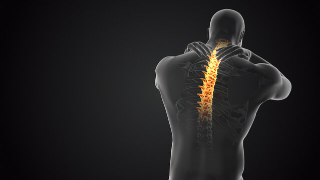 Neck joint and spine pain medical concept
