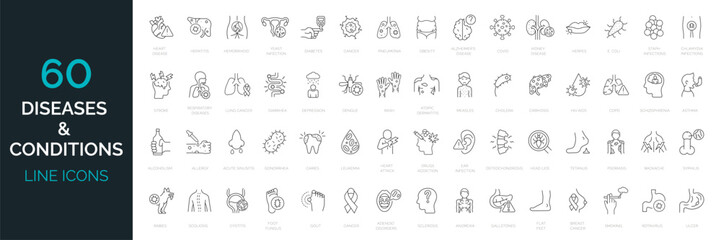 Set of 60 line icons related to diseases, illness, condition. Common diseases in the world. Outline icon collection. Editable stroke. Vector illustration
