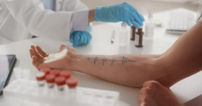 Close Up of a Patient Passing a Prick Scratch Allergy Test. Allergist Using Different Allergens on a Skin of a Young Man. Immunologist Diagnosing Allergy Triggers
