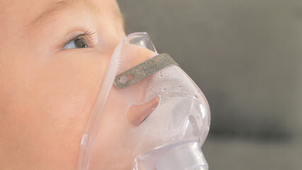 Close up of little baby boy is treated respiratory problem with vapor nebulizer to relief cough...
