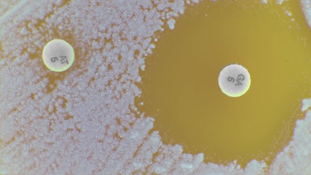 Bacterial colonies are grown in a Petri dish to test for antibiotic resistance. timelapse