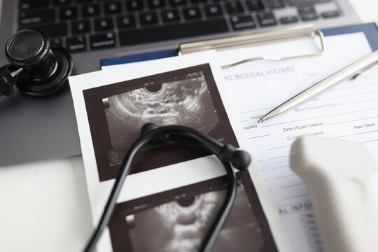 Modern ultrasound device with sensor and ultrasound of uterus