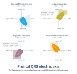 The frontal QRS electric axis is the average potential of the overall ventricular depolarization, and due to the dominant left ventricular mass, it is normally oriented to the left and inferior.