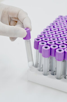 Purple vacuum blood collection tube with EDTA as anticoagulant for Complete blood count test in Medical laboratory.