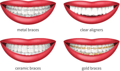 Teeth Braces Set