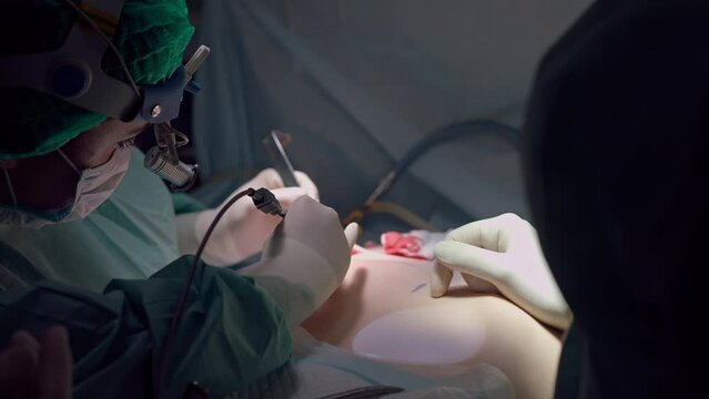 Surgery on breast augmentation in operating room indoors. Nurse helping doctor cleaning incision with tool in slow motion
